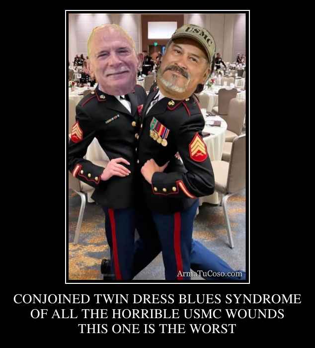 CONJOINED TWIN DRESS BLUES SYNDROME