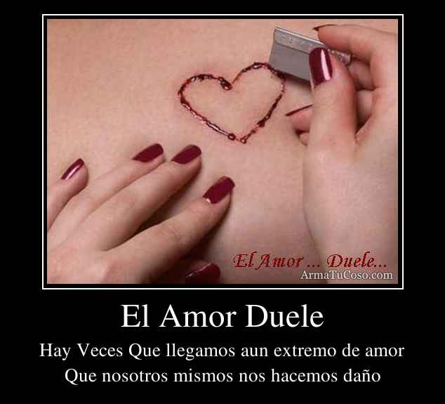 El Amor Duele 0294