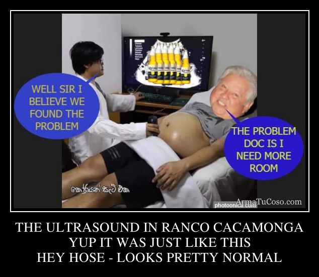 THE ULTRASOUND IN RANCO CACAMONGA